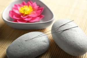 acupuncture chinese medicine harmonics